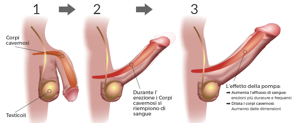 Quanto per aumentare un pene in Novosibirsk