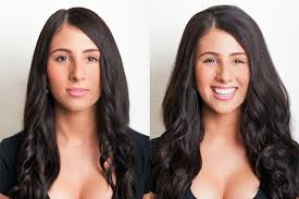 anche le donne possono beneficiare dell'infoltimento dei capelli anche le donne possono beneficiare dell'infoltimento dei capelli