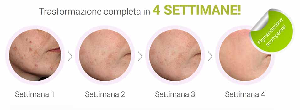 lumiskin trasformazione in 4 settimane lumiskin trasformazione in 4 settimane