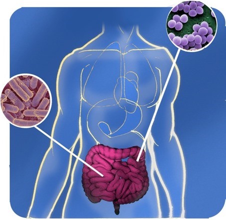 microbiota intestinale per curare il crohn microbiota intestinale per curare il crohn
