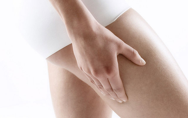 Nascondere la cellulite