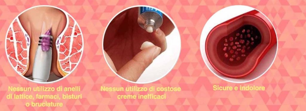 Come applicare Hemorrostop Come applicare Hemorrostop