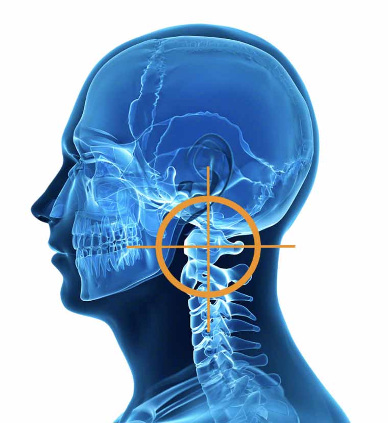 vertebra atlante posizionamento