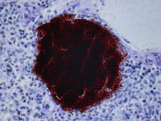 Visione Microspio Biopsia