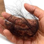 Come fermare la caduta dei capelli rimedi naturali e lozioni