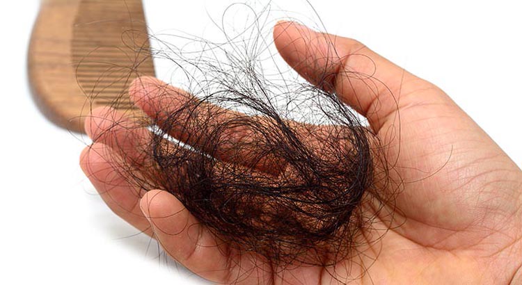 Come fermare la caduta dei capelli rimedi naturali e lozioni