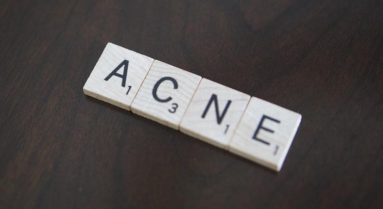 Acido azelaico e acne